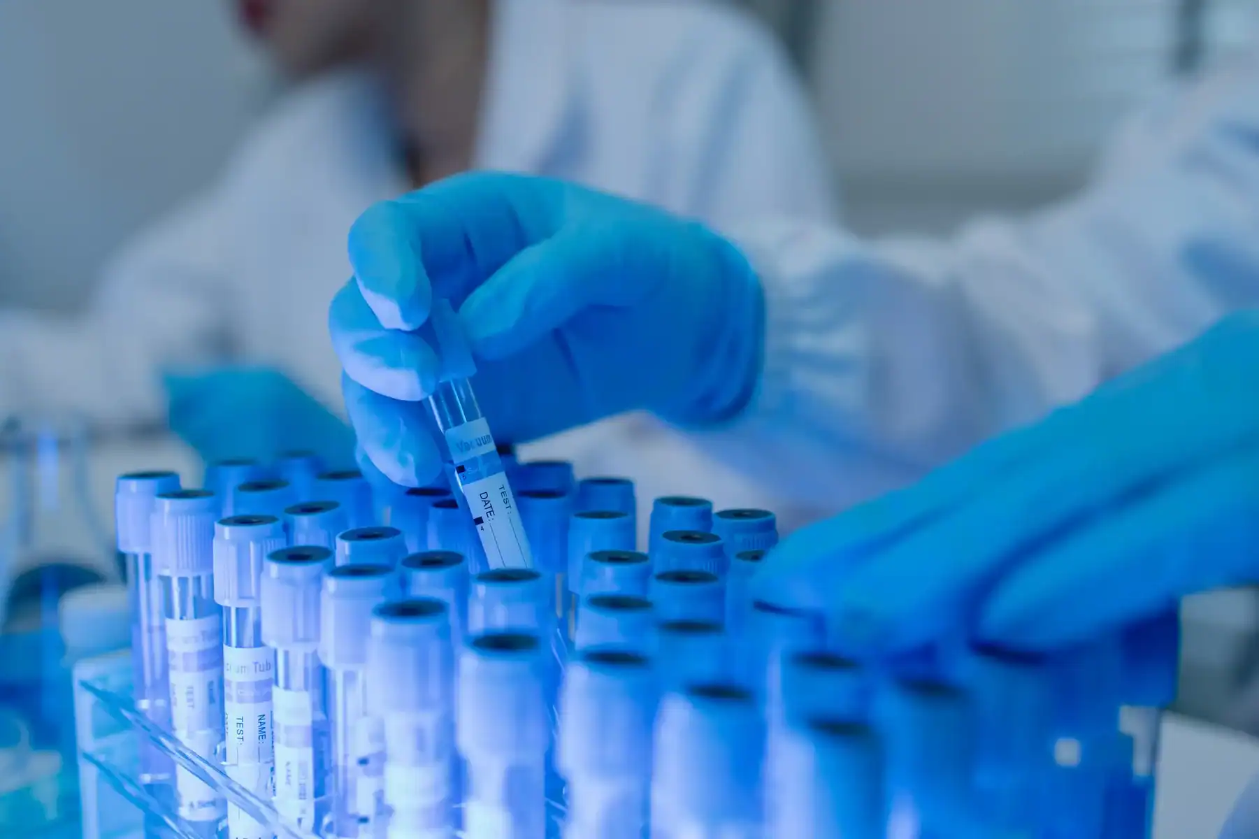Lab technician wearing blue gloves handling sample tubes in a laboratory